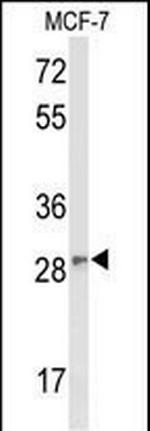 DAGLB Antibody in Western Blot (WB)