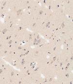 DLL3 Antibody in Immunohistochemistry (Paraffin) (IHC (P))