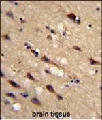 Cyclophilin C Polyclonal Antibody