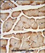 TMEM150A Polyclonal Antibody