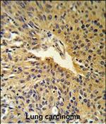 COG2 Polyclonal Antibody