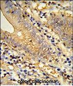 TSPAN33 Polyclonal Antibody