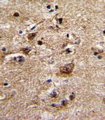 alpha-1b Adrenergic Receptor Polyclonal Antibody