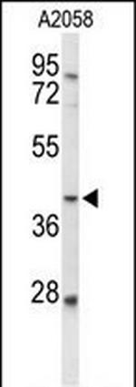 FUT3 Polyclonal Antibody