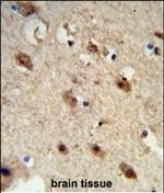 Acid Phosphatase 1 Antibody in Immunohistochemistry (Paraffin) (IHC (P))