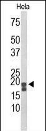 Acid Phosphatase 1 Antibody in Western Blot (WB)
