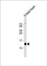HBA2 Polyclonal Antibody