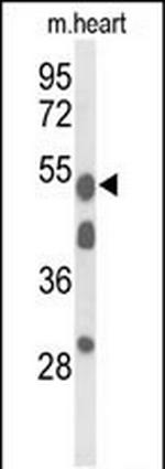 A1BG Polyclonal Antibody