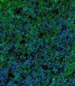 IL2RG Polyclonal Antibody