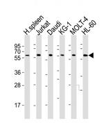 IL2RG Antibody in Western Blot (WB)