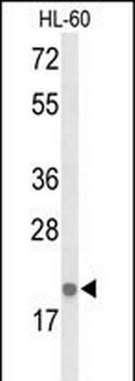 IL-26 Polyclonal Antibody