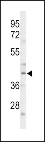 C/EBP alpha Polyclonal Antibody