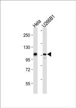 GEN1 Antibody in Western Blot (WB)