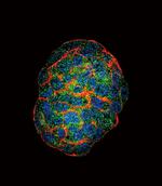 GBE1 Polyclonal Antibody