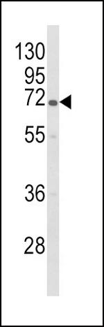 GBE1 Antibody in Western Blot (WB)
