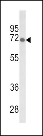 GBE1 Antibody in Western Blot (WB)