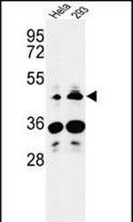 HS3ST2 Antibody in Western Blot (WB)