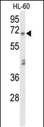 alpha Amylase 1 Antibody in Western Blot (WB)