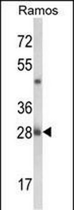 NUCKS1 Polyclonal Antibody