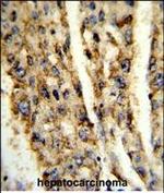 DIO3 Polyclonal Antibody