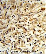 MAT2B Polyclonal Antibody