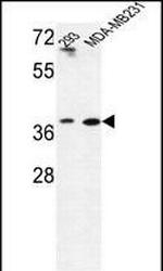 MAT2B Antibody in Western Blot (WB)