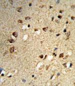 NCOA7 Polyclonal Antibody