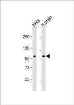 NCOA7 Antibody in Western Blot (WB)