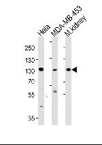NCOA7 Antibody in Western Blot (WB)