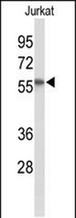 SACM1L Polyclonal Antibody