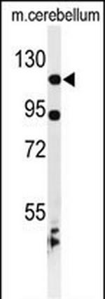 KIF6 Polyclonal Antibody