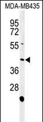 NOXA1 Polyclonal Antibody