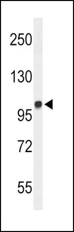 MICAL2 Polyclonal Antibody