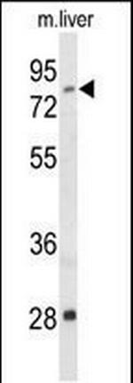 ACSS2 Polyclonal Antibody