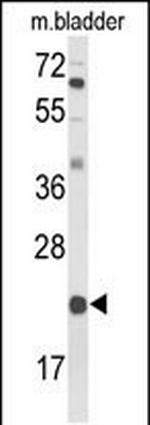 DGCR6 Polyclonal Antibody