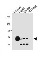 OATP2 Polyclonal Antibody