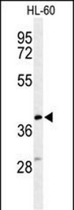 MT-CYB Antibody in Western Blot (WB)