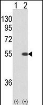STK40 Antibody in Western Blot (WB)