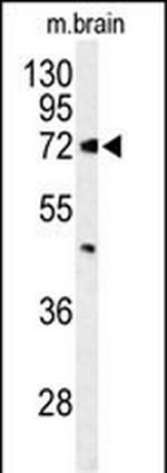 ABCD2 Polyclonal Antibody