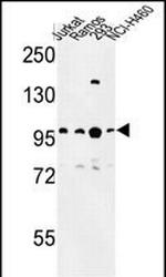 BCL11A Polyclonal Antibody