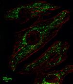 SLC25A37 Polyclonal Antibody