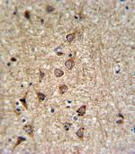 SLC25A37 Antibody in Immunohistochemistry (Paraffin) (IHC (P))