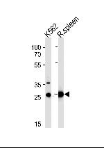 SLC25A37 Antibody in Western Blot (WB)
