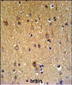 ZDHHC9 Polyclonal Antibody