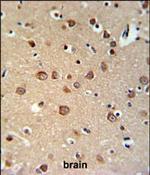 PDE6C Polyclonal Antibody