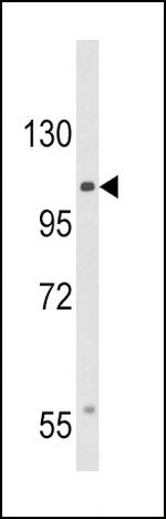 CACNA2D3 Polyclonal Antibody