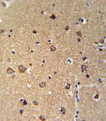 ANKH Polyclonal Antibody