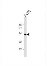 ANKH Antibody in Western Blot (WB)