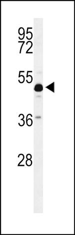 ANKH Antibody in Western Blot (WB)