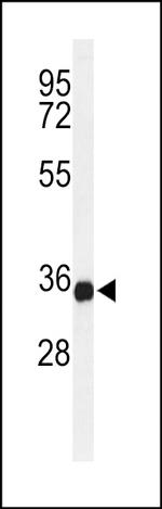 STING Polyclonal Antibody